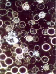 Dunkelfeldmikroskopie